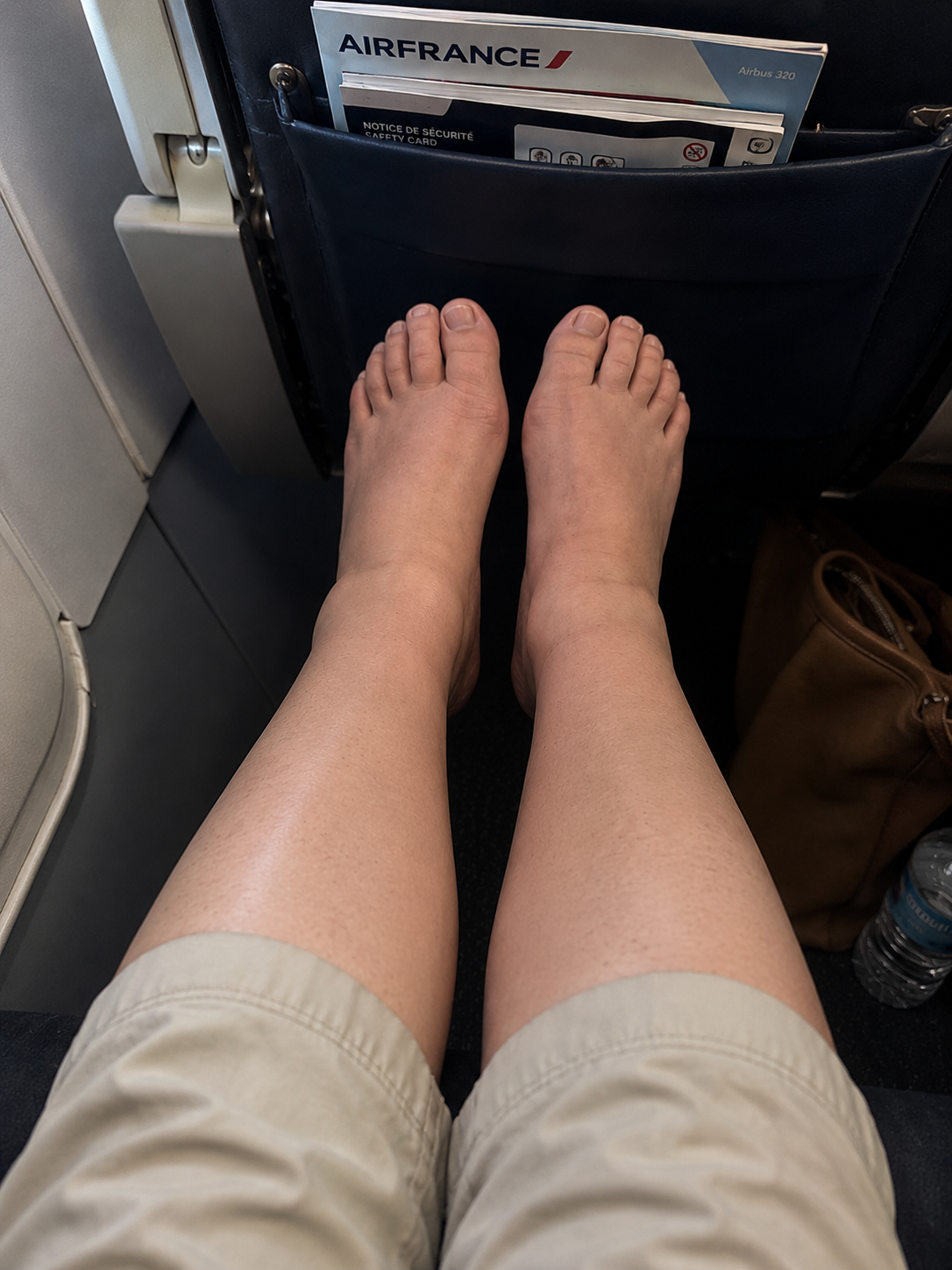 Pieds gonflés voyage